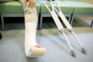 足首の骨折で歩けるまでの期間を短縮するポイント 手術or保存治療