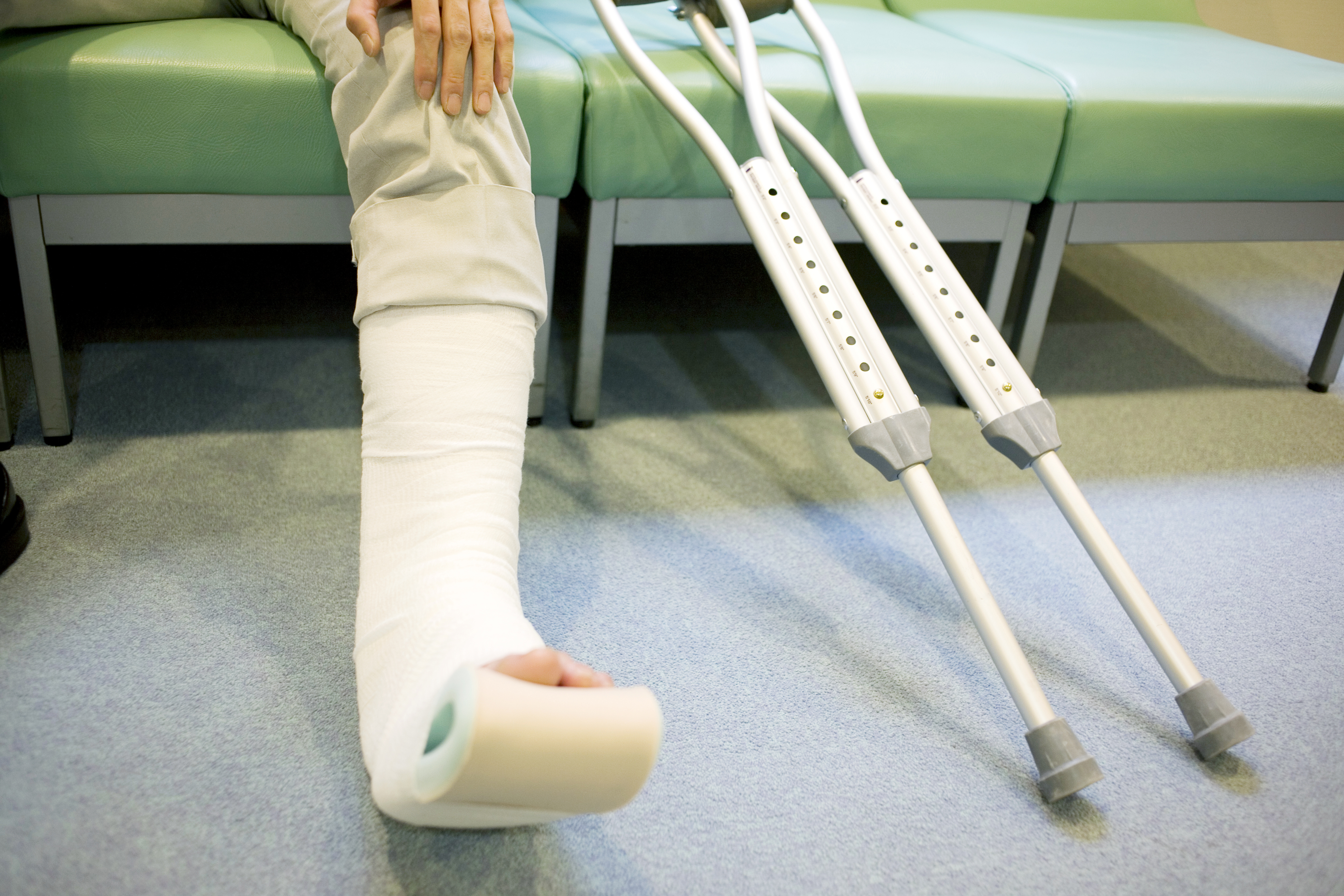 足の指の骨折 全治期間や治療を専門医が徹底解説