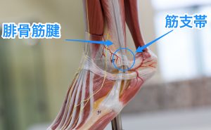 腓骨筋腱脱臼の症状は 手術は必要 専門医がわかりやすく 歌島大輔 オフィシャルサイト