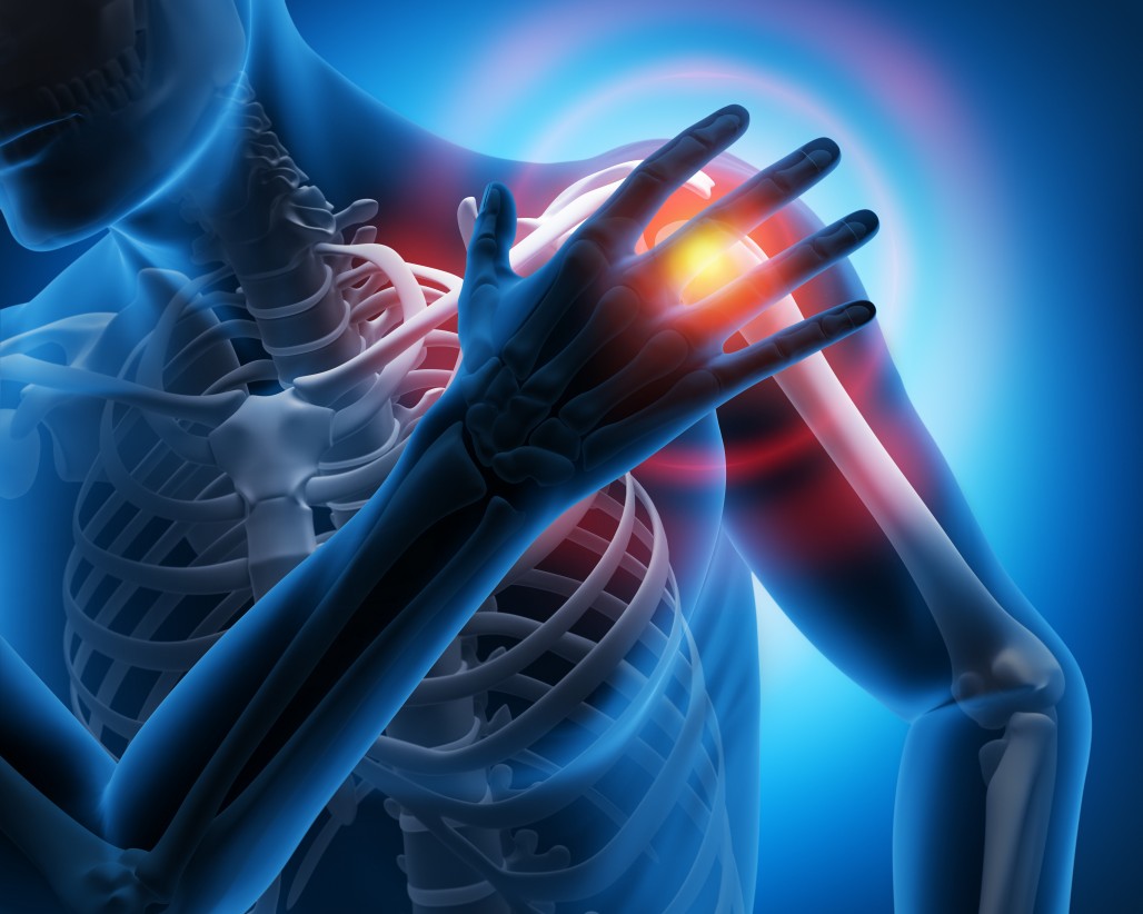 肩鎖関節を押すと痛いときに考えられる原因と治療を徹底解説
